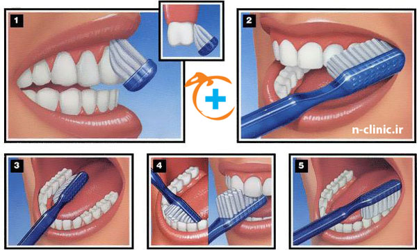 درمان دندان درد - نارنجستان - مسواک زدن - درمان ریشه - پوسیدگی دندان